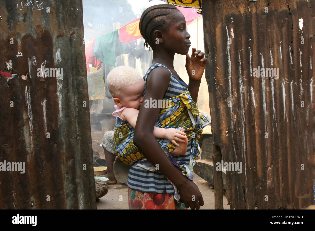 The Hunt for Albinos in Tanzania is Back